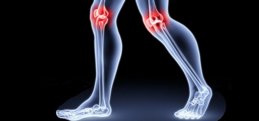 Легкость движений: как сохранить колени здоровыми?